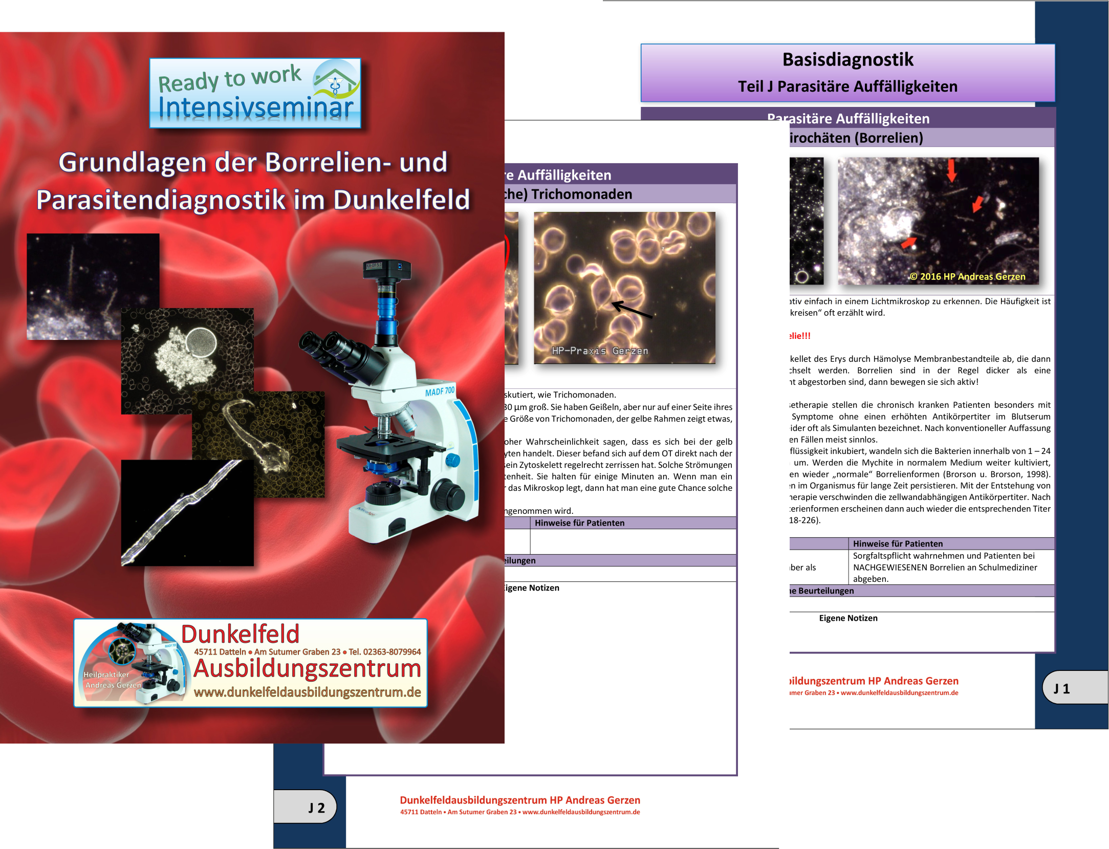 Script Borrelien